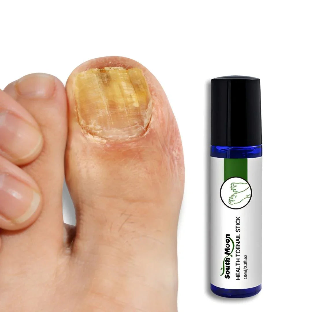 Thick discolored toenail with nail treatment stick for toenail care and grooming