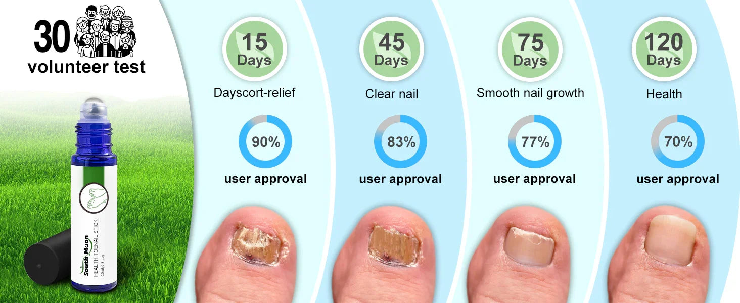 Toenail treatment progress chart showing improvement over 120 days, with before-and-after images and product bottle.